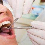 Why Regular Dental Checkups Are Essential for a Healthy Smile